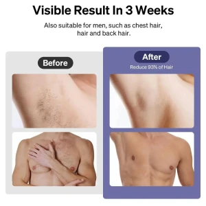 ULIKE Sapphire Air 3 IPL Hair Removal Device with Leather Case Purple ULK-IPL-AIR3-LCASE-PUR